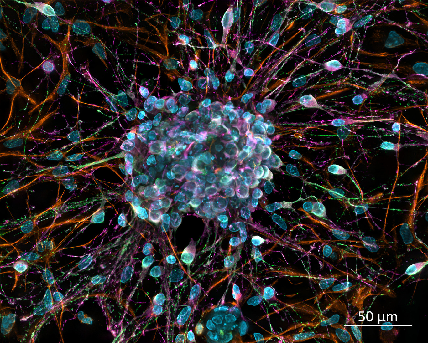 Hallan un nuevo tipo de neurona en el cerebro humano
