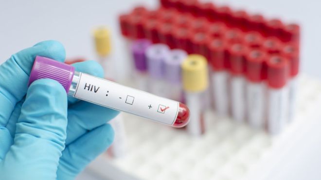Células madre, el último gran avance contra el VIH
