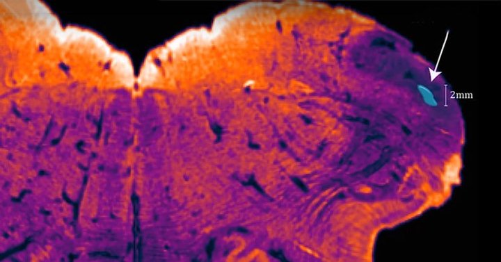 Neurocientífico descubre nueva región del cerebro humano