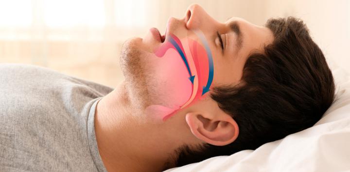 Tratan apnea del sueño contra disfunción eréctil
